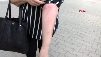 Adana genç kadını darp edip, üzerine siyah renkli sıvı madde döktüler