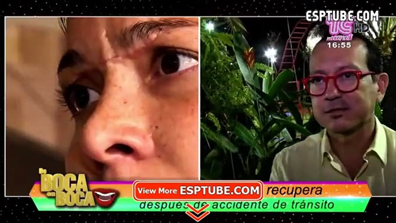 VIDEO |  Catherine Velasteguí viajó por su cicatriz a Estados Unidos ¿Qué le ocurrió? - ESPTUBE.COM