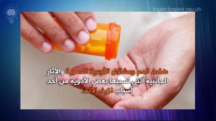 اسباب نزيف الانف وطرق علاجه