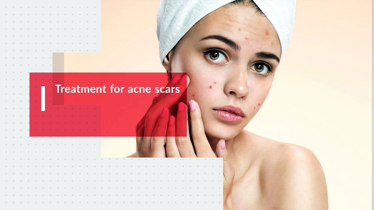 Why Easy Access and Local Services Means Greater Convenience for Cosmetic Treatment Patients - Canada MedLaser Inc.