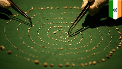 7歳男児の口内から526本の歯が摘出される インド - トモニュース