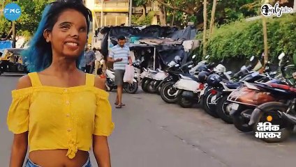 एक एसिड अटैक सर्वाइवर जो आज एक फैशन आइकन है