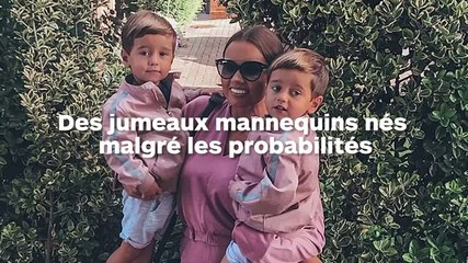 Ces jumeaux n’avaient que 10% de chance de survie… Ils sont aujourd’hui des mannequins enfants à succès