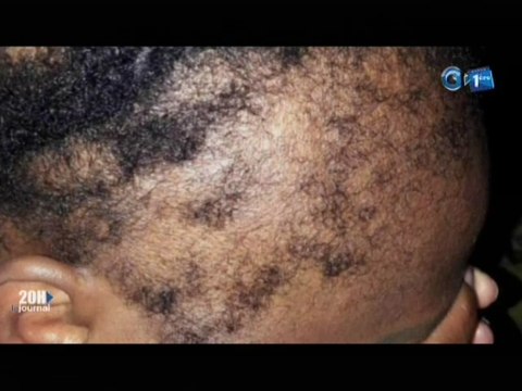 RTG/ Santé - Audience du représentant de l’organisation mondiale de la santé au Gabon avec le ministre de la santé