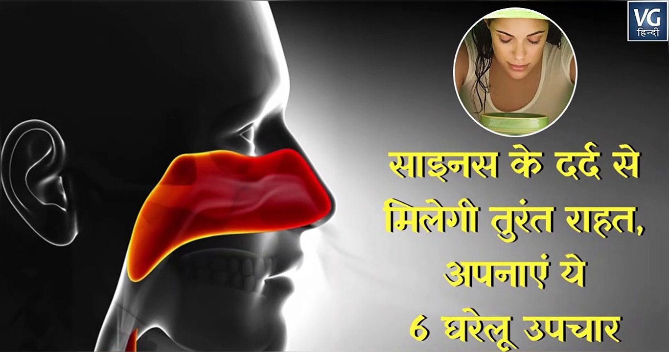 साइनस के दर्द से मिलेगी तुरंत राहत, अपनाएं ये 6 घरेलू उपचार