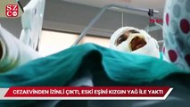 İstanbul’da kan donduran vahşet: Cezaevinden izinli çıktı, eski eşini yağ ile yaktı