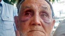 86 yaşındaki babasını satırla darp eden zanlı tutuklandı
