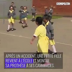 Cette petite fille montre sa prothèse à ses camarades