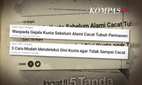 Kusta Bukan Akhir Dari Segalanya - BERKAS KOMPAS