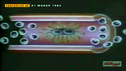 Fantástico - A descoberta da AIDS (Rede Globo 1983)