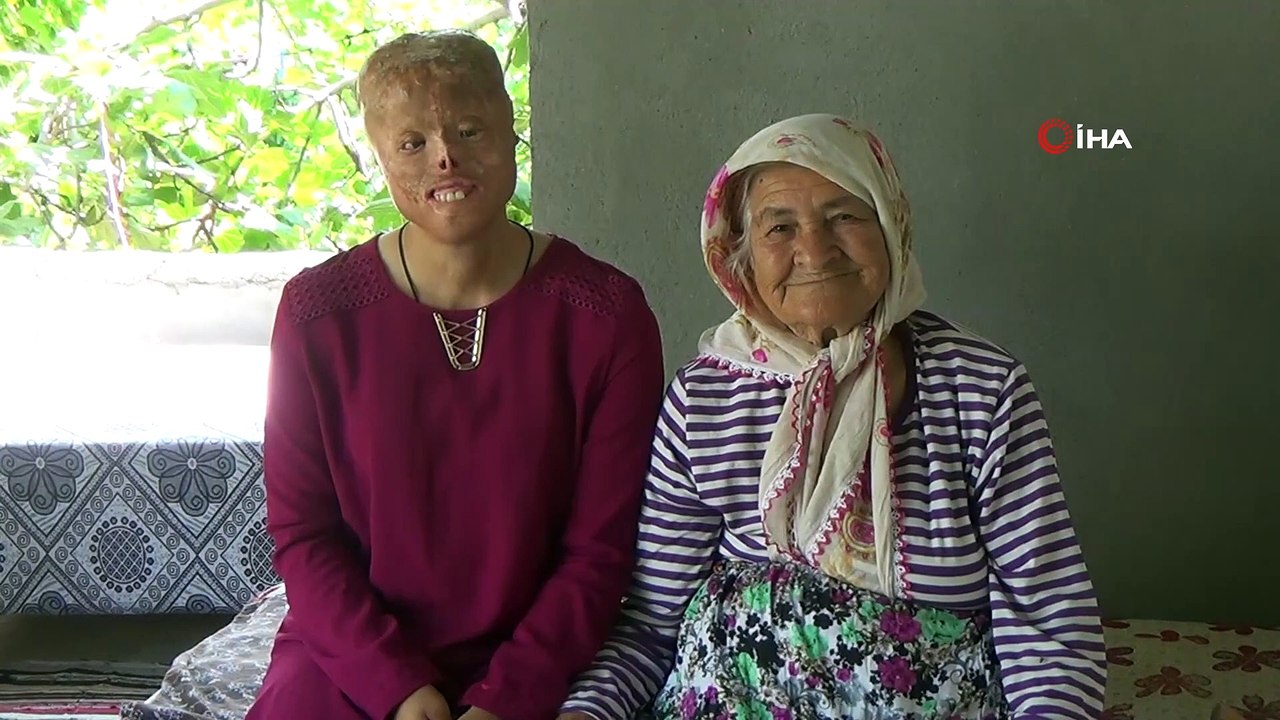 Leyla yeni yüzüne kavuşacağı günü bekliyor