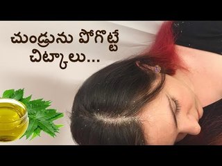 Dandruff: causes and treatments