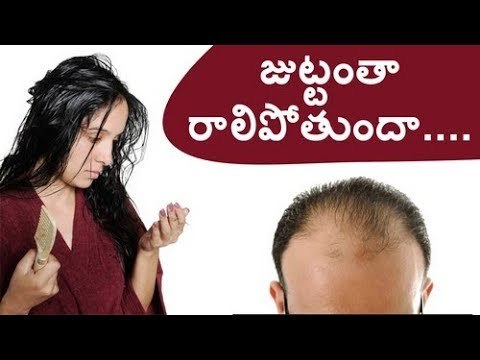 Home Remedies And Tips To Control Hair Fall - జుట్టంతా రాలిపోతుందా....