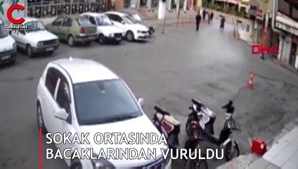Sokak ortasında bacaklarından vuruldu