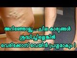 അറിഞ്ഞോളൂ... ചില കാര്യങ്ങൾ ശ്രദ്ധിച്ചില്ലെങ്കിൽ വെരിക്കോസ് വെയിൻ പ്രശ്നമാകും !