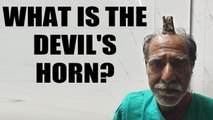 Man gets 'Devil's horn' removed: What is this condition? | Oneindia News