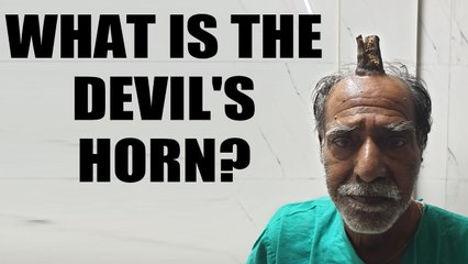 Man gets 'Devil's horn' removed: What is this condition? | Oneindia News