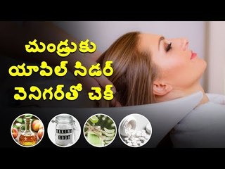 #Dandruff యాపిల్ సిడార్ వెనిగర్‌తో చుండ్రుకు చెక్  #Applecidervinegar #doctors #health