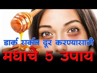 डार्क सर्कल दूर करण्यासाठी मधाचे 5 उपाय