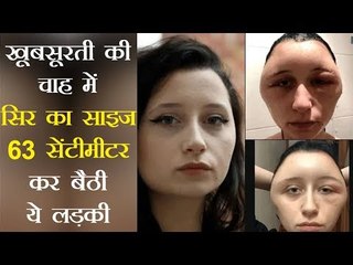 सुंदर बालों की चाह में लड़की को डाई करना पड़ गया महंगा, दोगुना हो गया सिर का साइज
