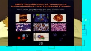 [Doc] WHO classification of tumours of haematopoietic and lymphoid tissues: Vol. 2 (World Health