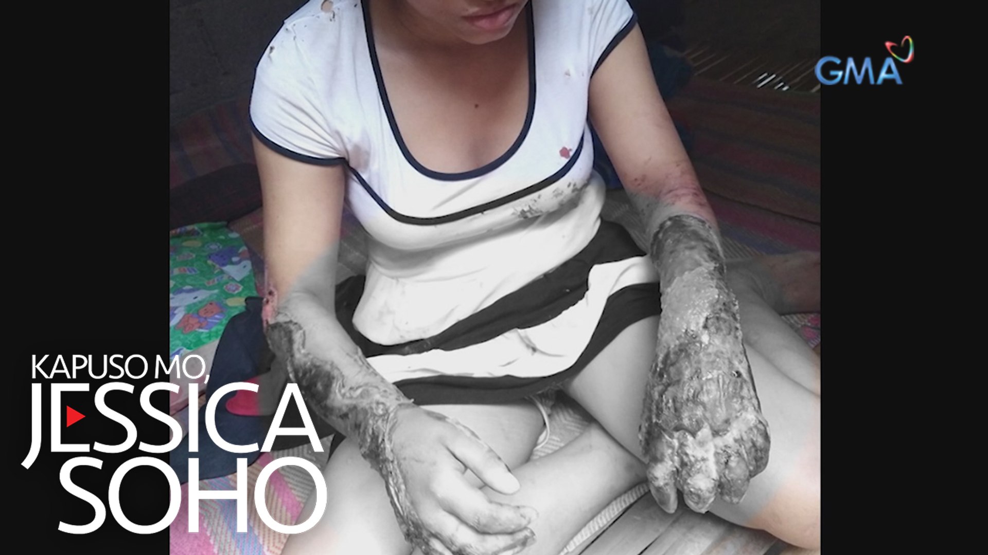 Kapuso Mo, Jessica Soho: Babae, binuhusan ng kumukulong tubig!