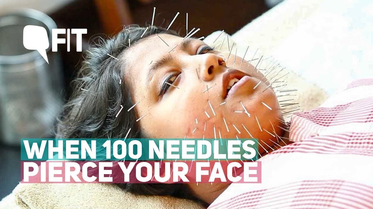 Cosmetic Acupuncture: I Got 100 Needles Pierced on my Face for Beauty and Lived to Tell the Tale | Quint Fit