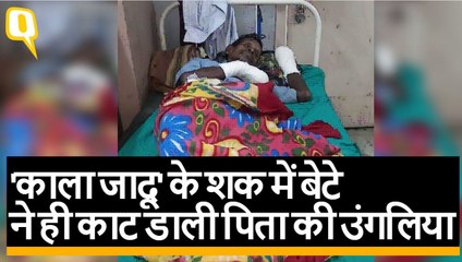 West Bengal: ‘काला जादू’ के शक में बेटे ने काटी बुजुर्ग पिता की सभी उंगलियां