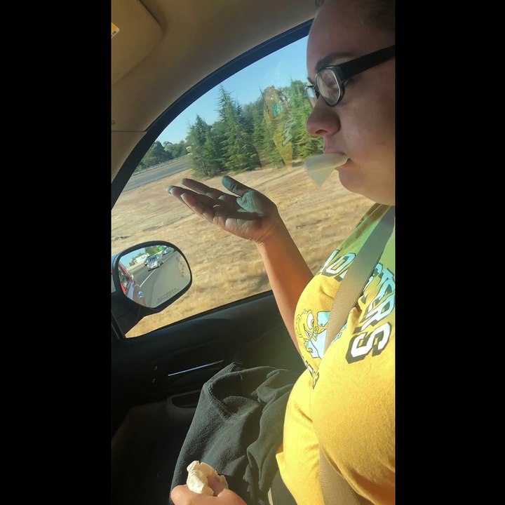 Wisdom Teeth Woes