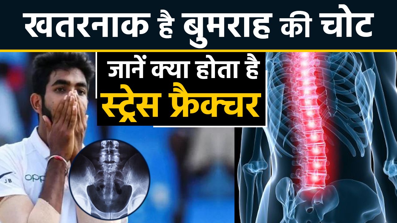 Stress fracture: How serious is Jasprit Bumrah's injury, Know all about Stress fracture | वनइंडिया