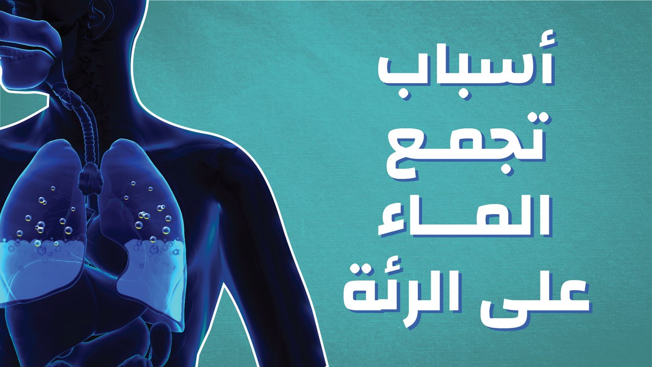 أسباب تجمع الماء على الرئة