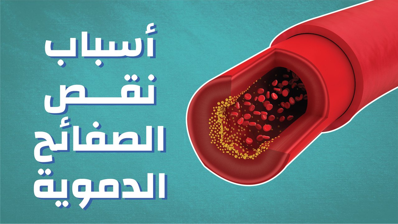 أسباب نقص الصفائح الدموية