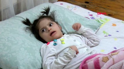 Tokat kalp ve epilepsi hastası ülkü serenay, yürümek için yardım bekliyor