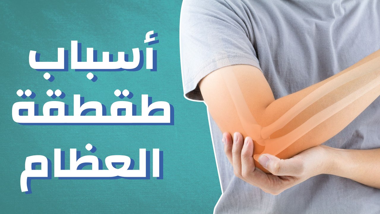 أسباب طقطقة العظام