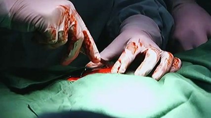 Victor, nalagay sa panganib matapos mabaril