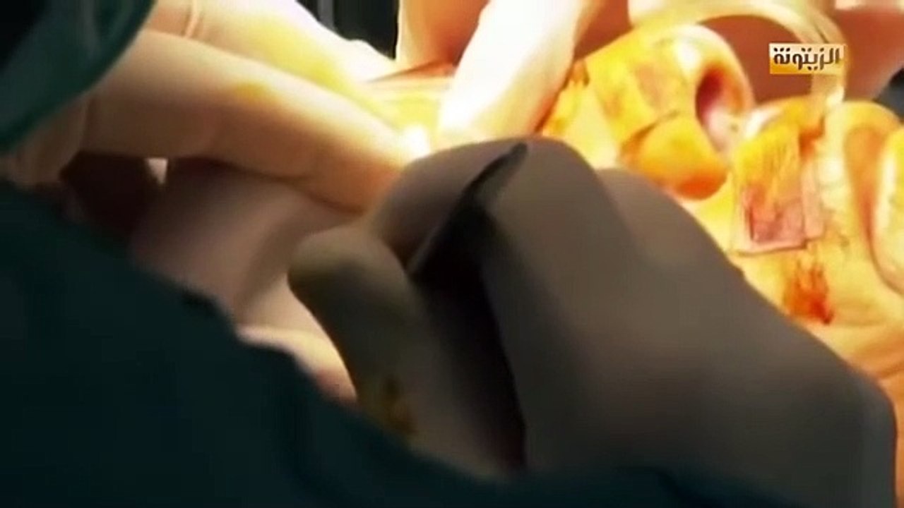 وثائقي - التنويم بين الموت و الحياة