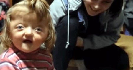 Kafası ve parmakları büyük olduğu için küçük kızı okula almadılar