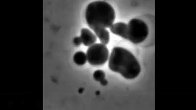Antibiotic Removed: Osmoprotective Media From L-Form To Walled Form