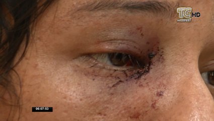 Joven fue golpeado brutalmente por negarse a vender droga en Guayaquil