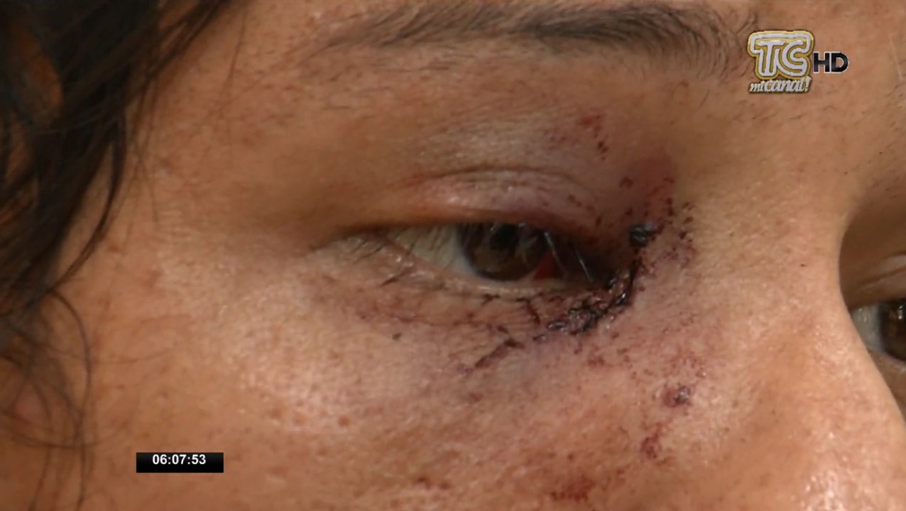 Joven fue golpeado brutalmente por negarse a vender droga en Guayaquil