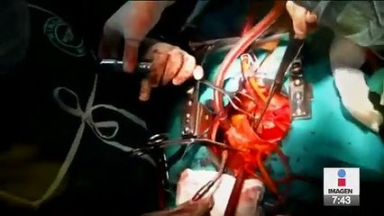 Así es la vida de una beneficiaria de un trasplante de corazón