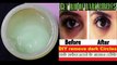 DIY Remove dark Circles, How to remove dark Circles,डार्क सर्कल हटाने के आसान तरीके,काले घेरे हटाएं