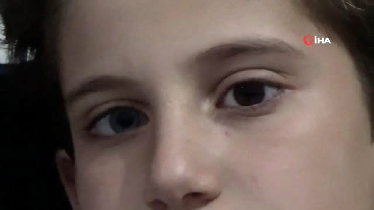 Gören dönüp bir daha bakıyor... Selman kardeşlerin bir gözü mavi, bir gözü kahverengi