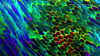 Incredible Tooth Imaging Reveals How Enamel Lasts a Lifetime