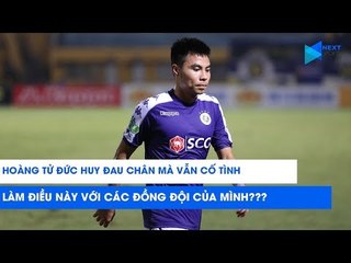 Chân đau vì chấn thương, nhưng Đức Huy vẫn làm điều này để trêu các đồng đội của mình? | NEXT SPORTS