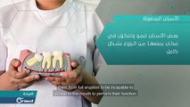 ماذا تعرف عن الأسنان المدفونة.. وما أسباب ظهورها؟