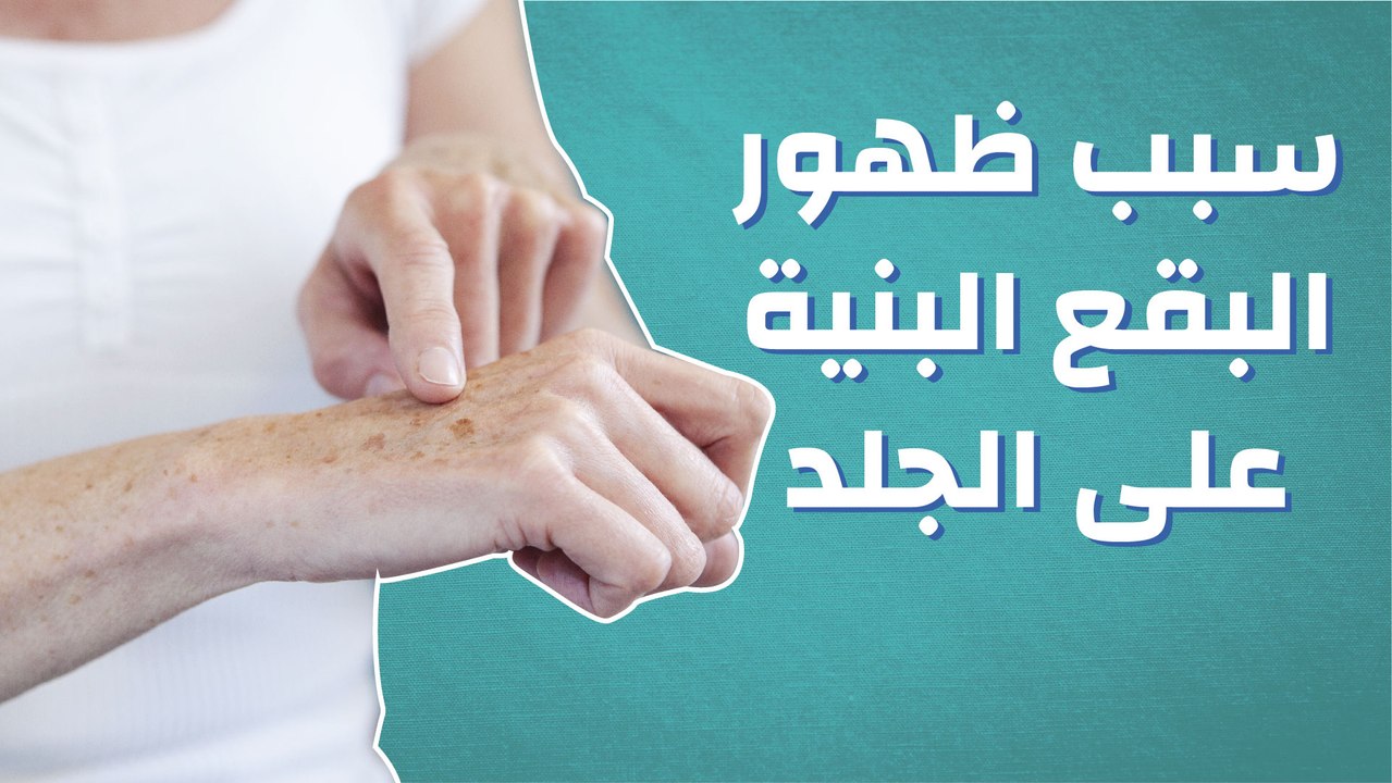 سبب ظهور بقع بنية على الجلد