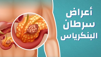 سرطان البنكرياس اعراضه