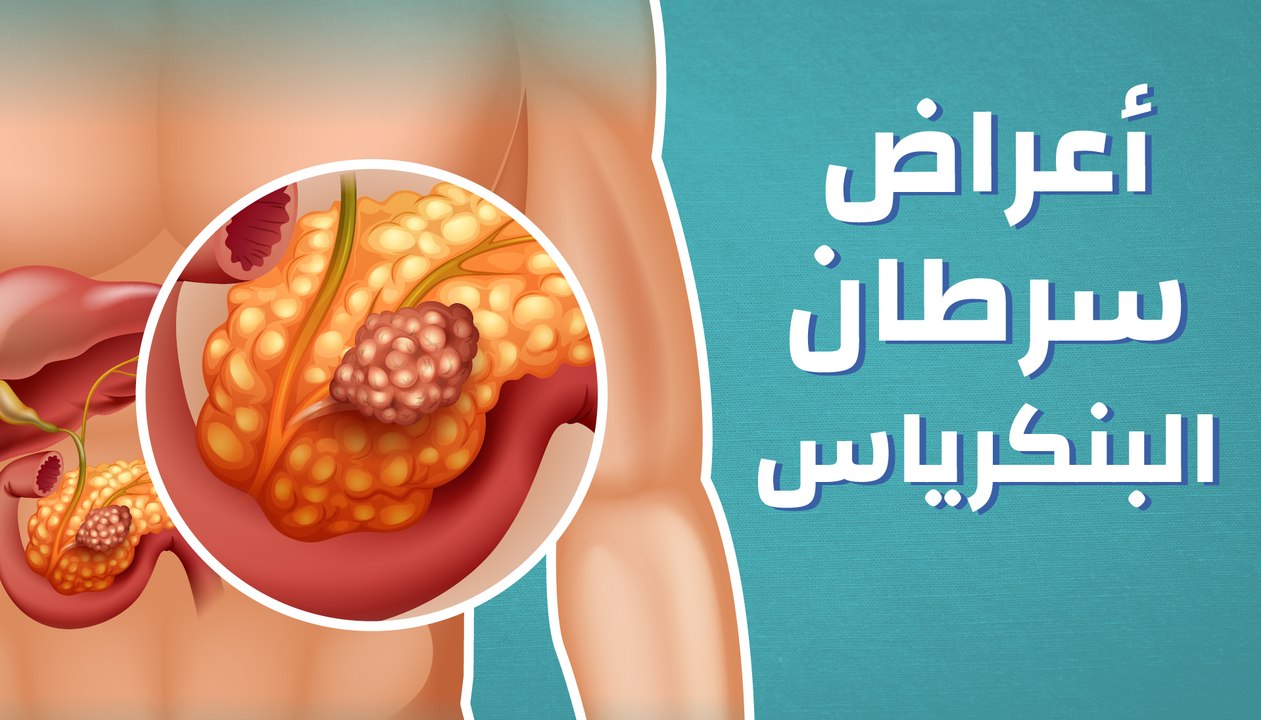 سرطان البنكرياس اعراضه