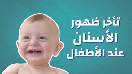 تأخر ظهور الأسنان عند الأطفال